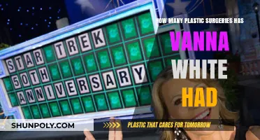Vanna White's Plastic Surgery Journey: Rumors, Facts, and Transformations