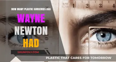 Unveiling Wayne Newton's Plastic Surgery Journey: Rumors and Reality