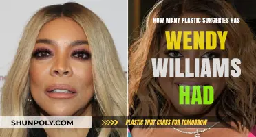 Wendy Williams' Plastic Surgery Journey: Unveiling Her Transformation