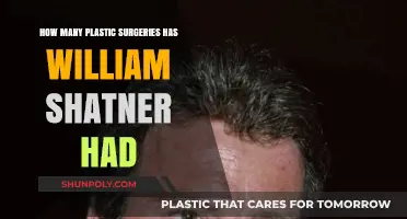 Unveiling William Shatner's Plastic Surgery Journey: Fact vs. Speculation