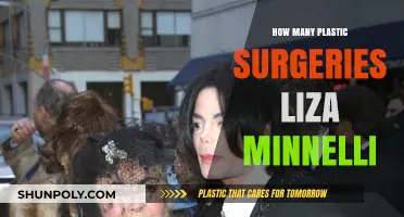 Liza Minnelli's Plastic Surgery Journey: Rumors, Facts, and Transformations