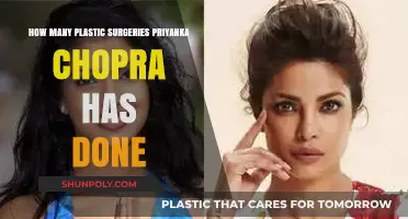Priyanka Chopra's Transformation: Unveiling Her Plastic Surgery Journey