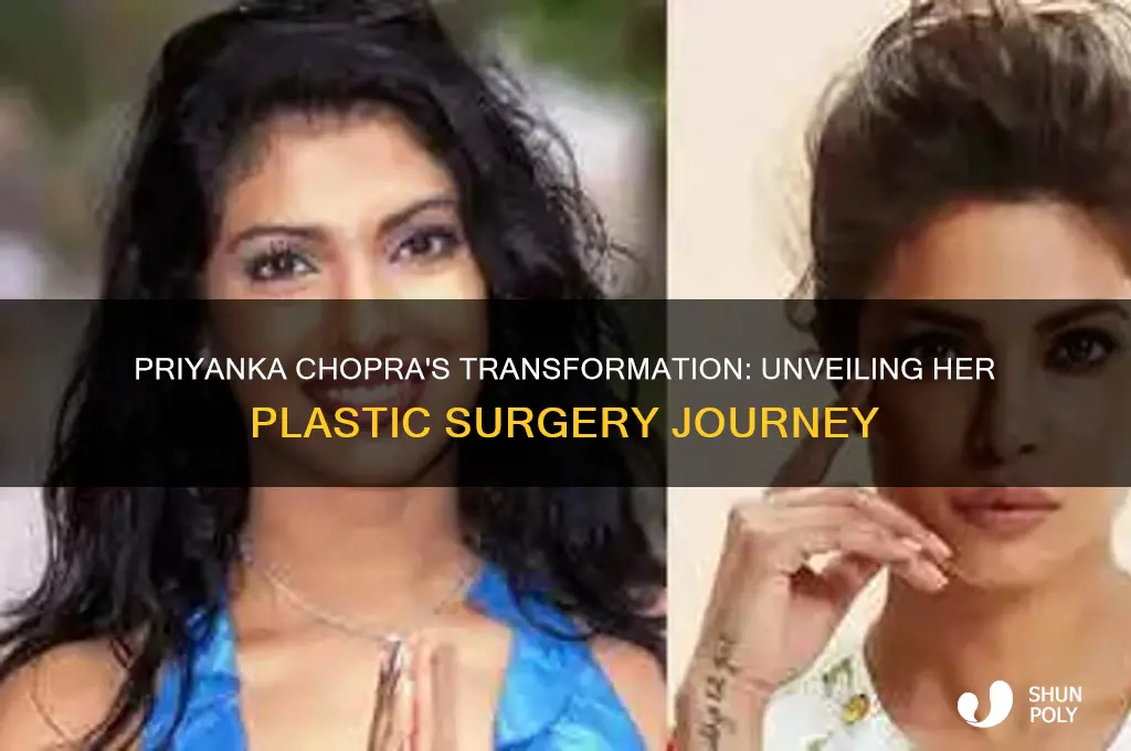 how many plastic surgeries priyanka chopra has done