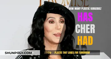 The Evolution of Cher's Look: Multiple Plastic Surgeries