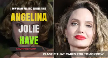 Angelina Jolie's Plastic Surgery Journey: Rumors, Facts, and Transformations