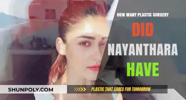 Nayanthara's Transformation: Unveiling Her Plastic Surgery Journey and Speculations