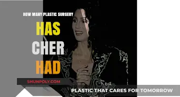 Cher's Transformation Journey: Unveiling Her Plastic Surgery Procedures