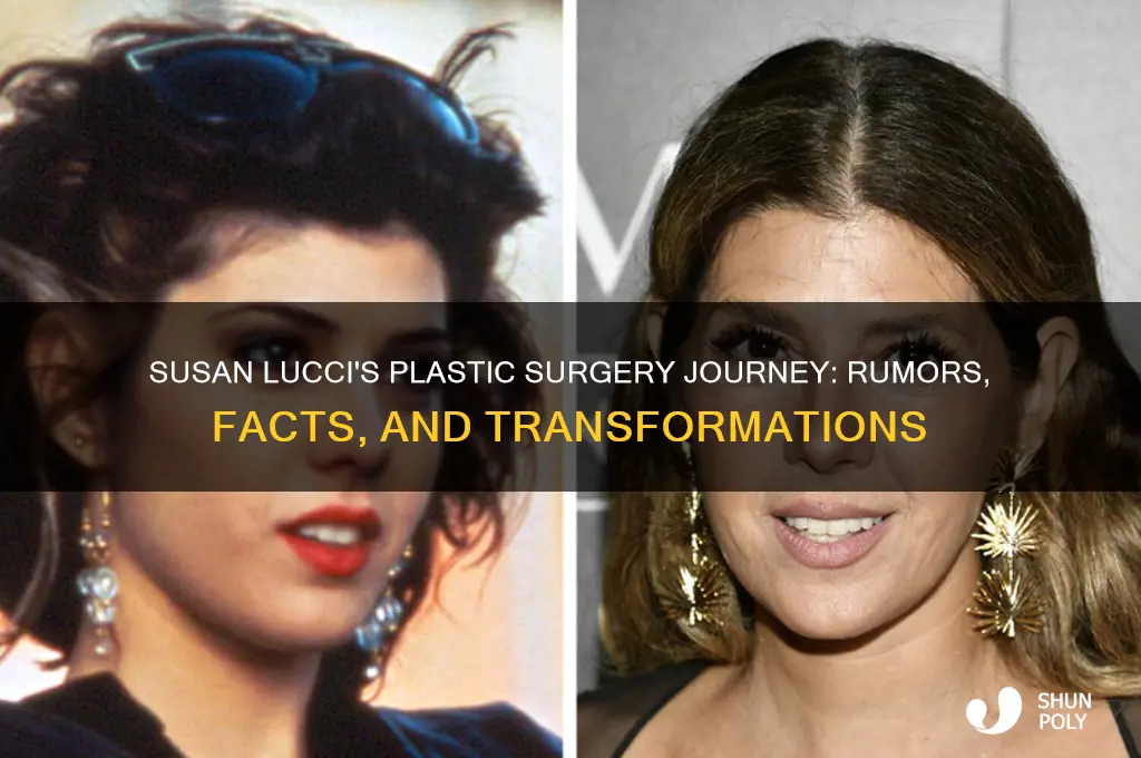 how many plastic surgery has susan lucci had