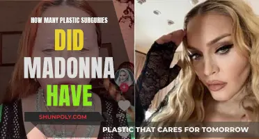 Madonna's Transformation: Plastic Surgery Secrets Revealed