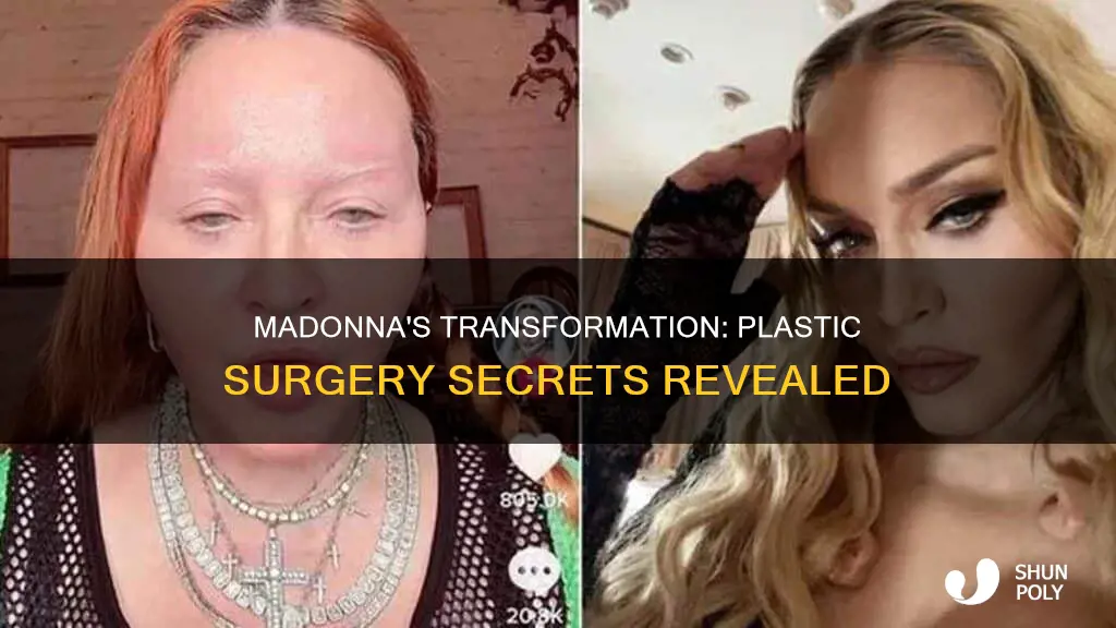 how many plastic surguries did madonna have