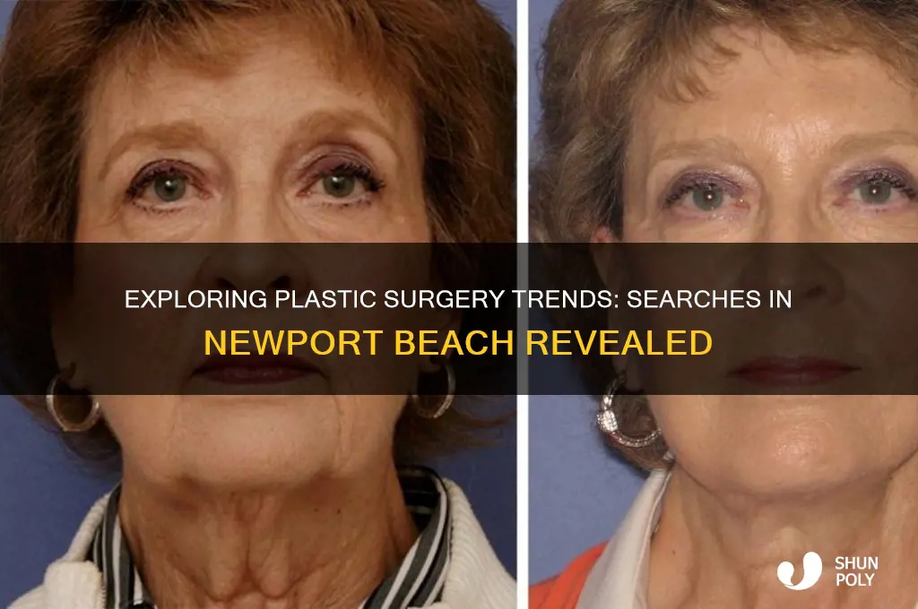 how many searches plastic surgery newport beach