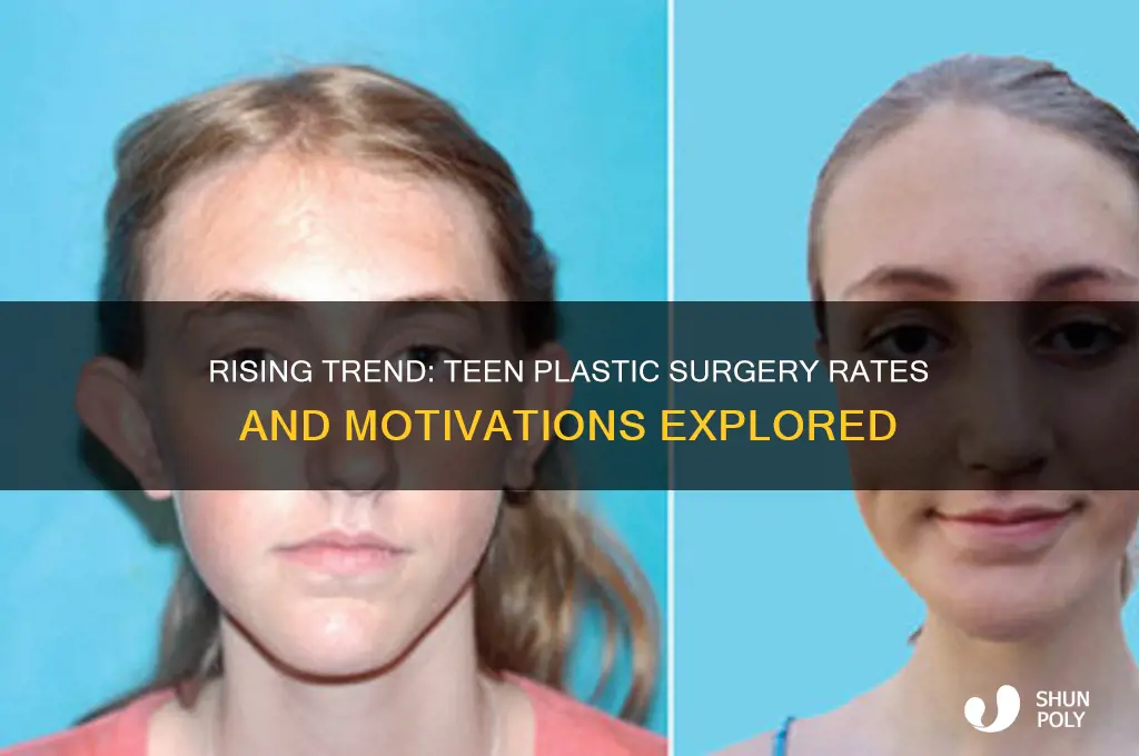 how many teenagers get plastic sugery