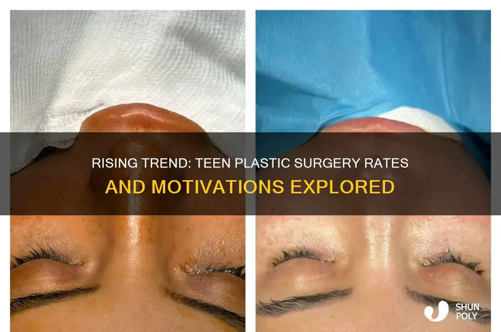 how many teens get plastic surgery