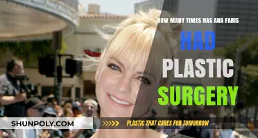 Ana Faris Plastic Surgery: Unveiling the Truth Behind Her Transformations