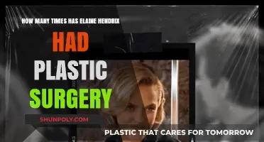 Elaine Hendrix's Plastic Surgery Journey: Rumors and Reality Explored
