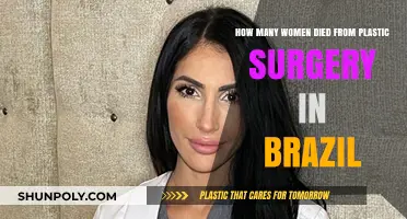 Brazil's Plastic Surgery Deaths: How Many Women Lost Their Lives?