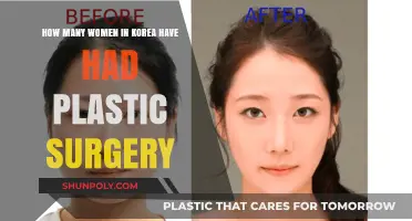 Exploring the Prevalence of Plastic Surgery Among Korean Women