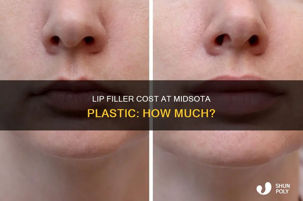 how much are lip filler at midsota plastic