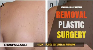 Lipoma Removal Plastic Surgery Costs: What to Expect Financially