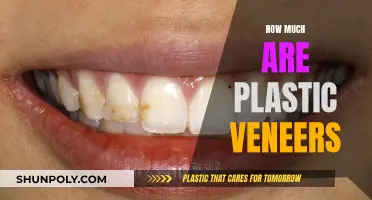 The Cost of Plastic Veneers: How Much Do They Cost?