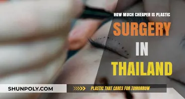 Affordable Plastic Surgery in Thailand: Cost Savings Revealed