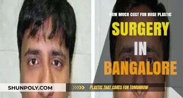 Nose Plastic Surgery Cost in Bangalore: Affordable Rhinoplasty Options