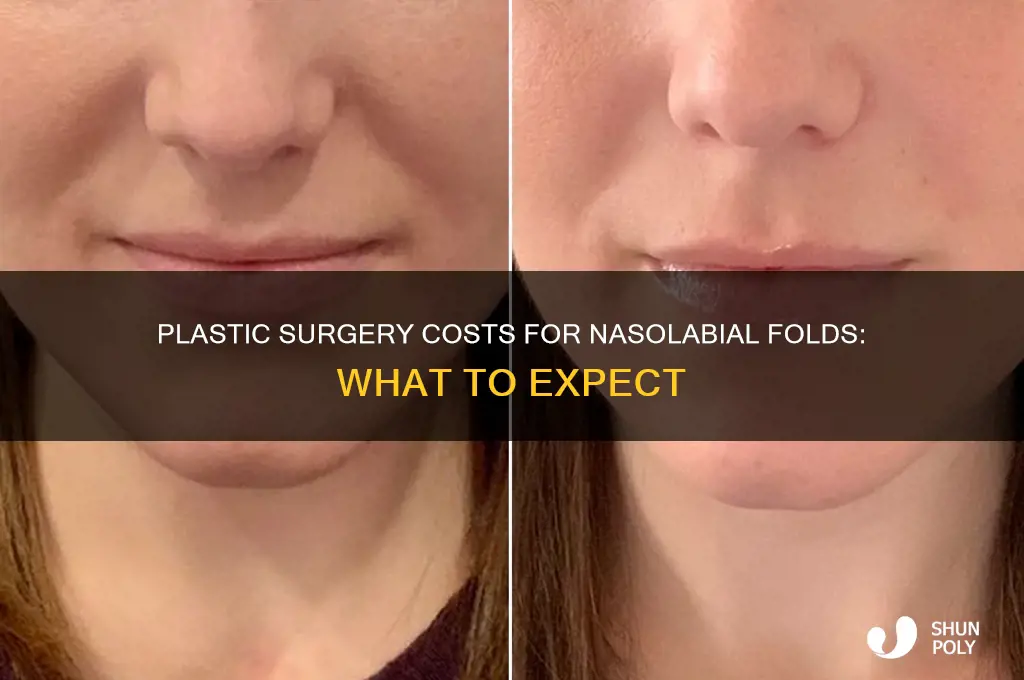 how much cost for plastic surgery for nasolabial folds