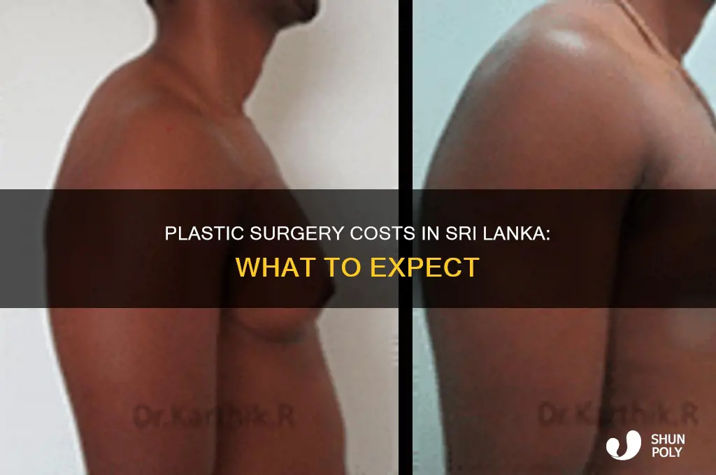 how much cost for plastic surgery in sri lanka