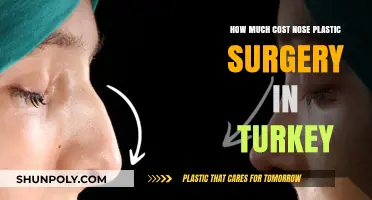 Nose Plastic Surgery in Turkey: Cost, Procedure, and Recovery Guide