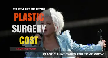 Cyndi Lauper's Plastic Surgery: Unveiling the Cost of Her Transformation
