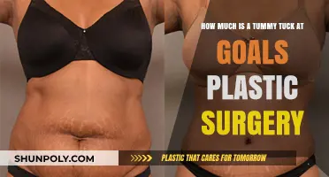 Tummy Tuck Costs at Goals Plastic Surgery: What to Expect