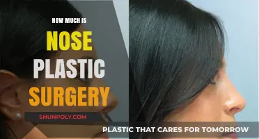 Nose Plastic Surgery Cost: What to Expect Financially