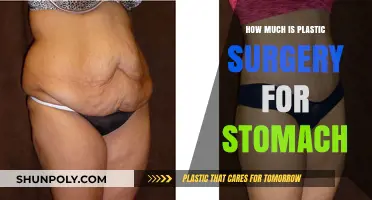 Stomach Plastic Surgery Costs: What to Expect Financially