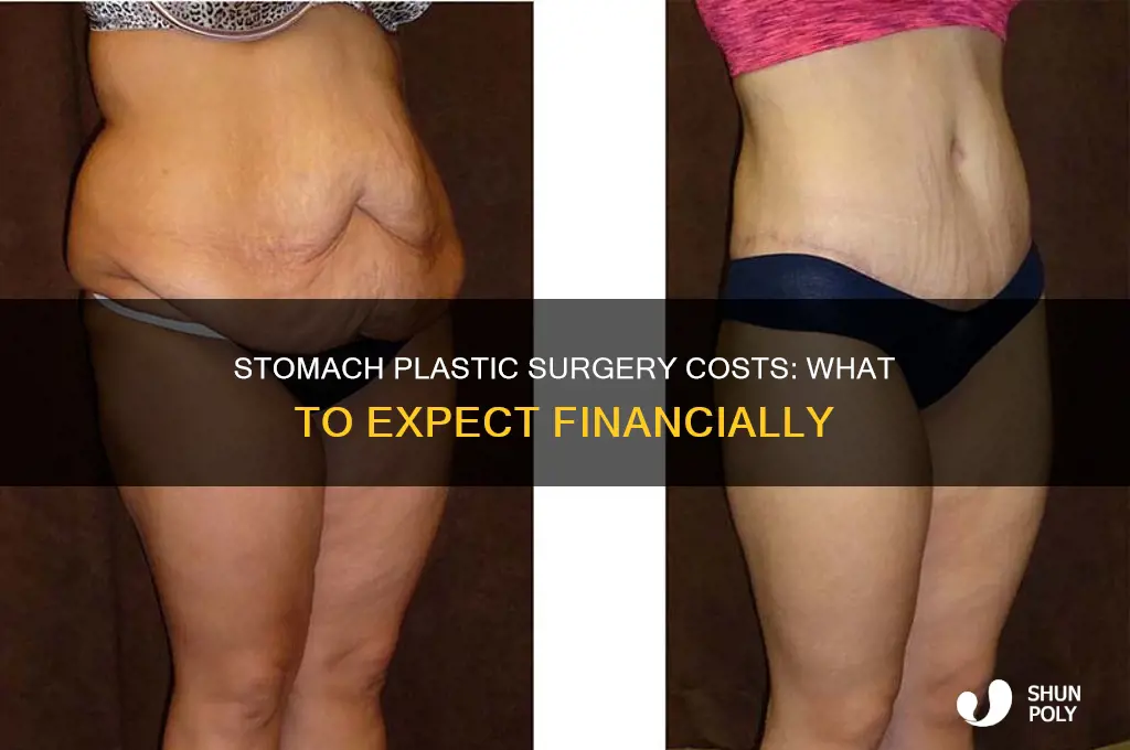 how much is plastic surgery for stomach