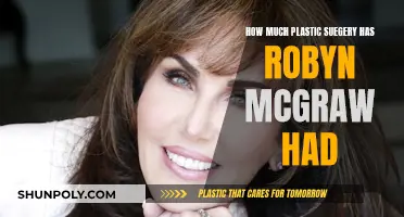 Plastic Surgery Speculations: Robyn McGraw's Transformation