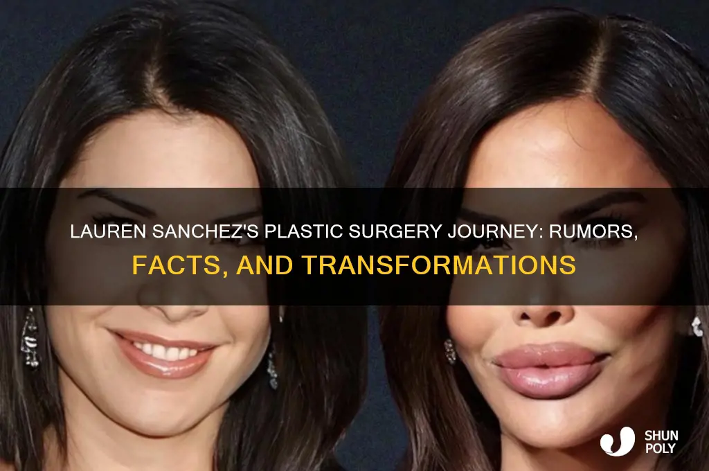 how much plastic surgery has lauren sanchez had