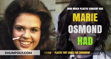 Marie Osmond's Plastic Surgery Journey: Transformations and Speculations