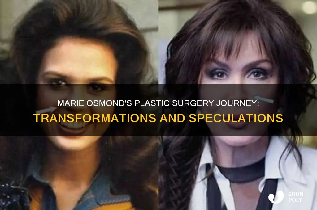 how much plastic surgery has marie osmond had