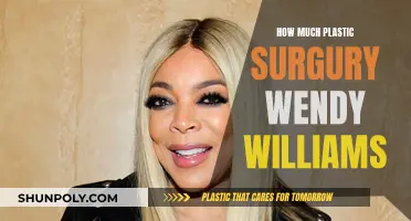 Wendy Williams' Plastic Surgery Transformation: A Comprehensive Overview