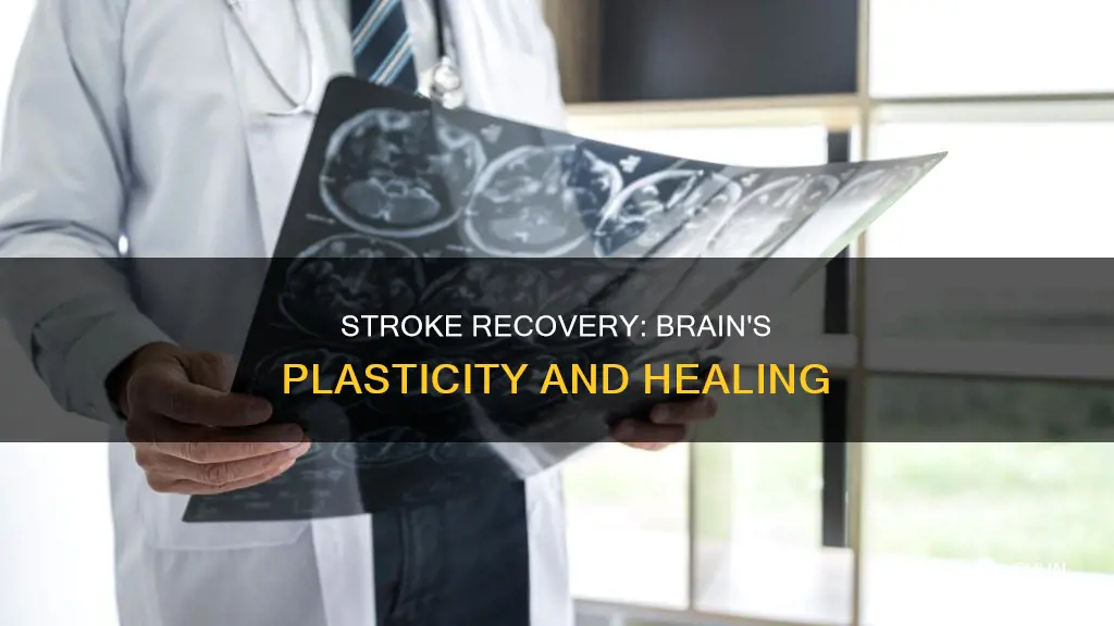 how people after stroke brains plasticity