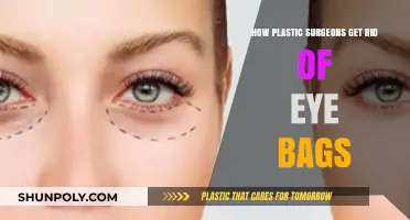 Effective Eye Bag Removal Techniques Used by Plastic Surgeons