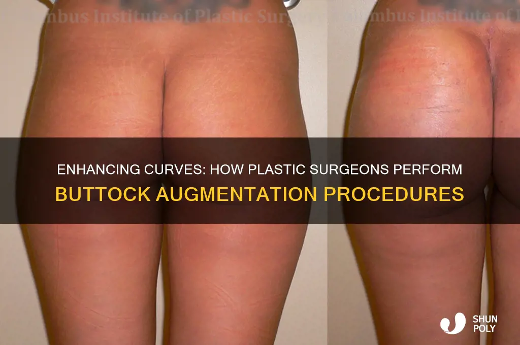 how plastic surgeons make women s ass bigger