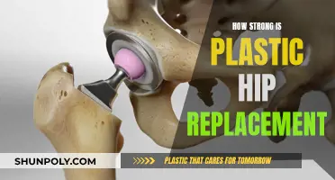 Hip Replacements: Are Plastic Joints Strong?