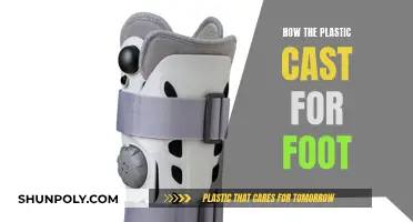 Plastic Casting: Foot Healing Process