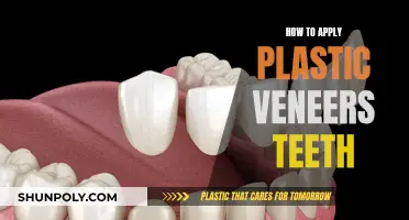 Applying Plastic Veneers: A Guide for Teeth Transformation