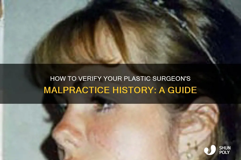 how to check if plastic surgeon had malpractice suits