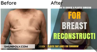Choosing the Right Plastic Surgeon for Breast Reconstruction: A Comprehensive Guide