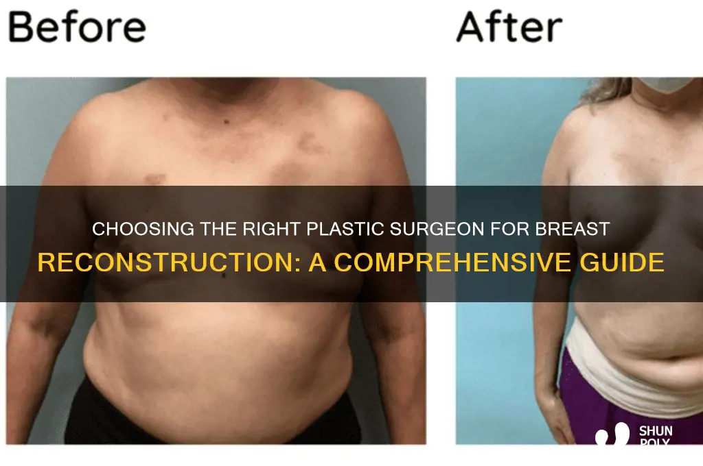 how to choose a plastic surgeon for breast reconstruction