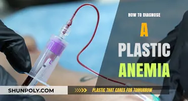 Diagnosing Plastic Anemia: What You Need to Know