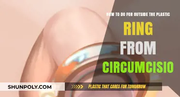 Breaking Free: A Guide to Removing Circumcision Plastic Rings Safely